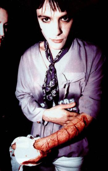 Richey Edwards dopo uno dei suoi atti di autolesionismo. 